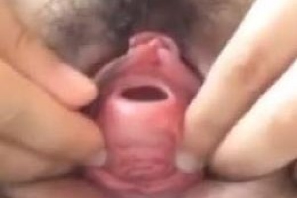 这么粗长的塑料棒插入美女尿道 还拼命往里摁 最后貌似出不来了 女人尿道很短 它去了哪里