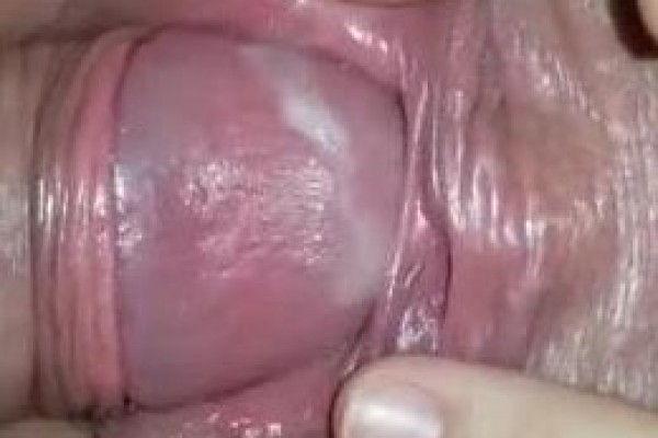 尿道性交特写 用力 这么肥嫩的鲍鱼 偏偏要插尿道 尿尿都出来了 貌似还能内射