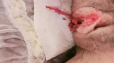 长相超级甜美笑起来红唇齿白实在诱惑，来个姨妈秀，鲜血淋淋